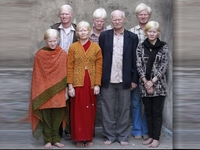 Cei mai albinosi frati din lume